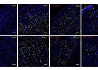 脐带间充质干细胞和脐带血单个核细胞可改善学习和记忆能力