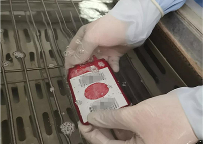 脐带血“小救大”再度上演 地中海贫血女孩重获新生