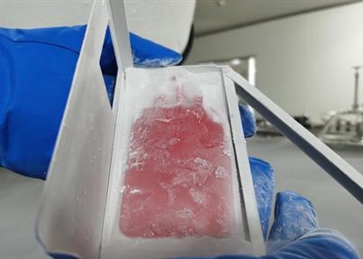 在-196℃温度下“沉睡”了14年，这份脐带血成功复苏去救命