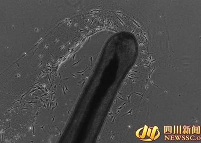 新生命干细胞公司培养出“毛囊干细胞”打响“头发保卫战”第一枪