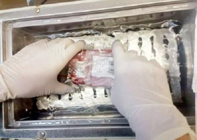 冻存13年后 成都好人捐赠的脐带血赴闽救人